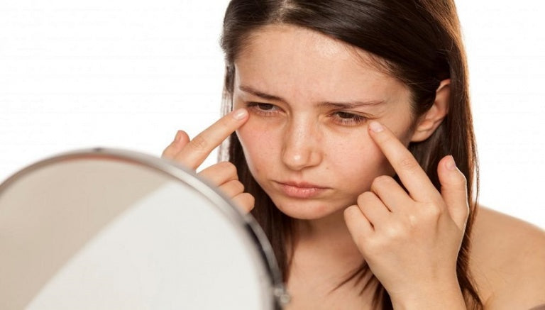 HOW TO GET RID OF DARK CIRCLES IN 6 EASY STEPS.