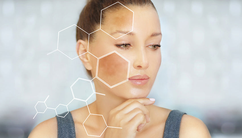 ALL YOU NEED TO KNOW ABOUT HYPER PIGMENTATION.