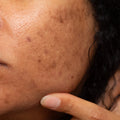 Dark Spot