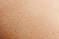 Dry & Dull Skin